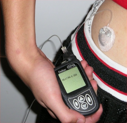 File:Insulin pump with infusion set.jpg