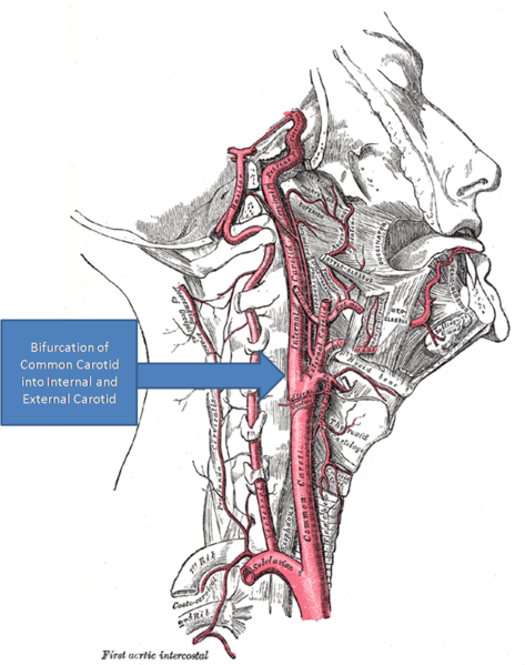 File:473px-Gray's Anatomy with markup showing carotid artery bifurcation.png