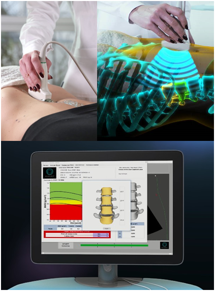 File:REMS technology spine scan.png