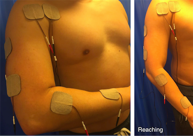 Muscle Stimulator: Is It Effective Enough?