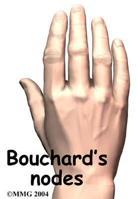Bouchard.jpg