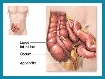 File:Appendix.jpg