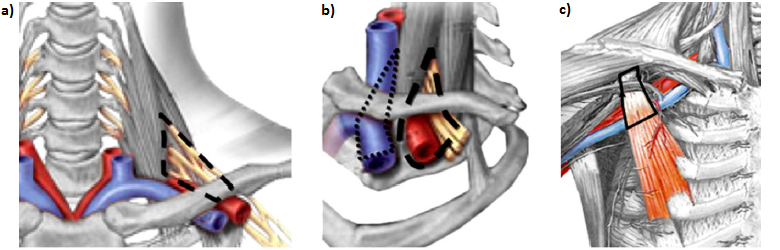 File:Spaces of the thoracic outlet.png