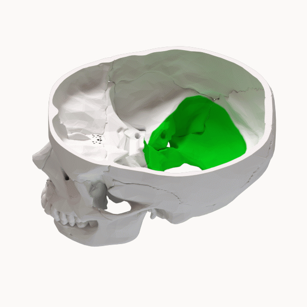 File:Posterior cranial fossa - animation.gif
