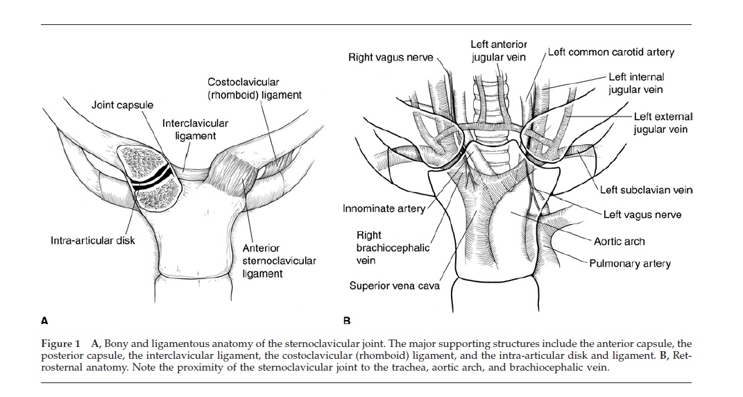 Figure adapted from: Higginbotham TO, Kuhn JE. Atraumatic disorders of the sternoclavicular joint. Journal of the American Academy of Orthopaedic Surgeons. 2005;13:138-145.