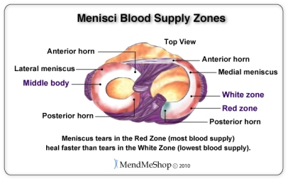 Meniscus-blood-supply-zones.jpg