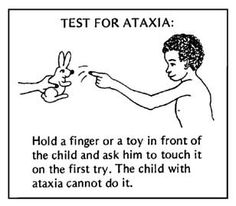 Test for ataxia.jpg