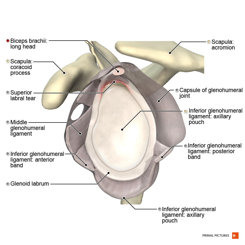 Illustration of SLAP II lesion.png