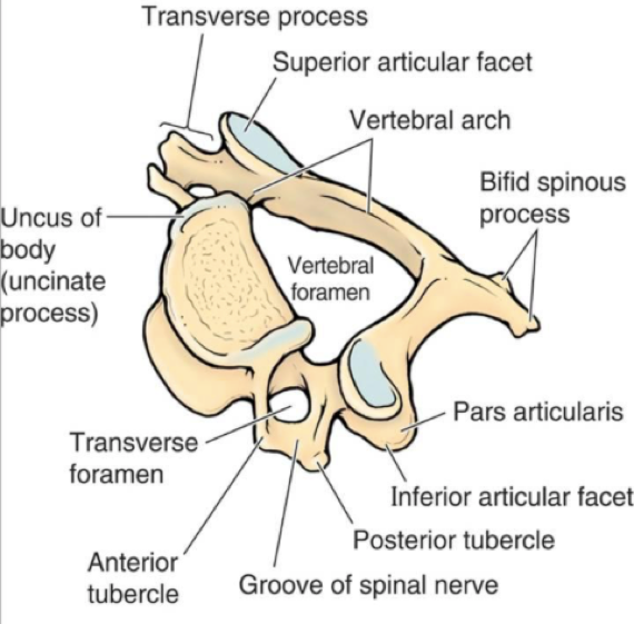 File:Anatomy of a Lumbar Vertebrae.png