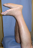 Achilles tendon: Function, location, Thompson test