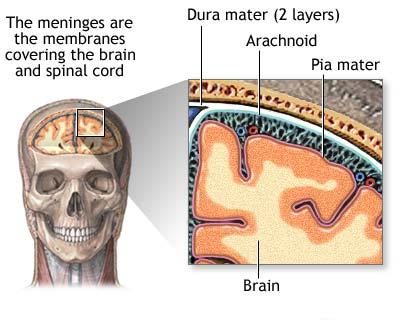 Subarachnoid Hemorrhage (SAH) - Brain, Spinal Cord, and Nerve Disorders -  Merck Manuals Consumer Version