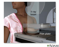 Mammogram.jpg