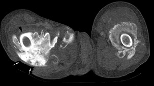 HO CT scan.jpg