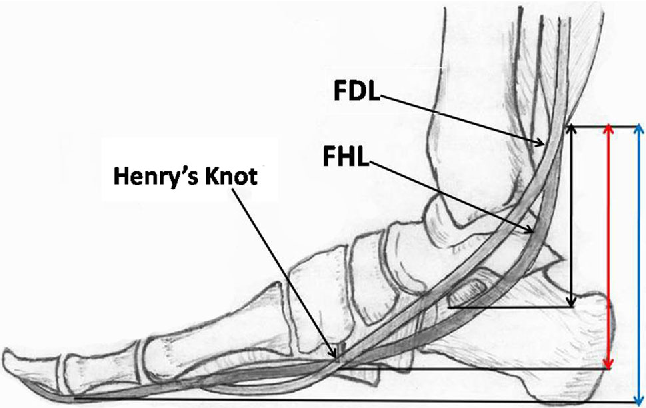 File:Henry's Knot.png