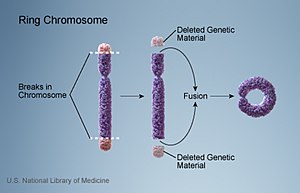 File:Ring chromosome.jpg