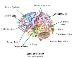 Brain2.jpg