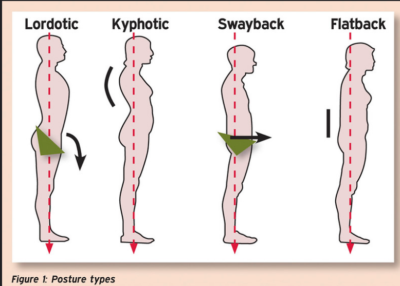 File:Posture Types.png