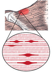 schematic of a trigger point