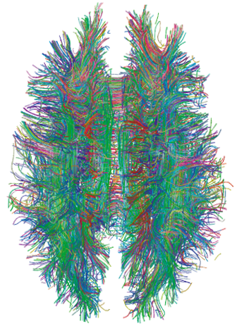 File:White Matter Connections Obtained with MRI Tractography.png