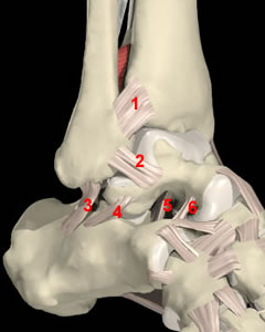 Figure 1: an image of the ankle, with the sinus tarsi between the talus and calcaneus, and the ligaments in the sinus (numbers 5 and 6)