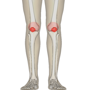 A patellofemorális ízület deformáló artrózisa, A térdízület patellofemoralis arthrosisza