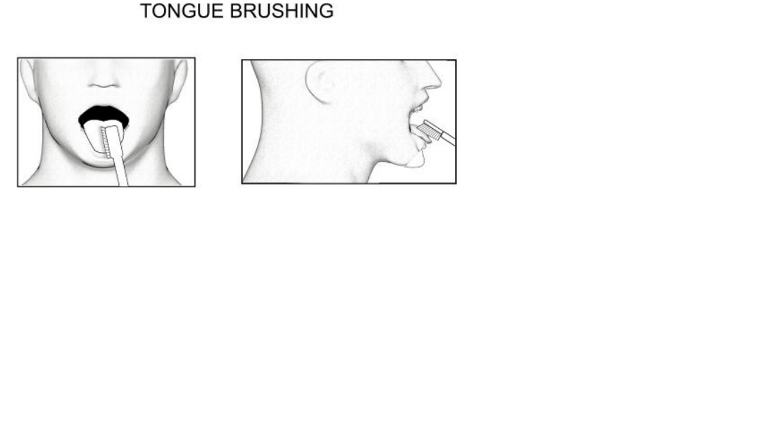 Tongue brushin Exercise1.png