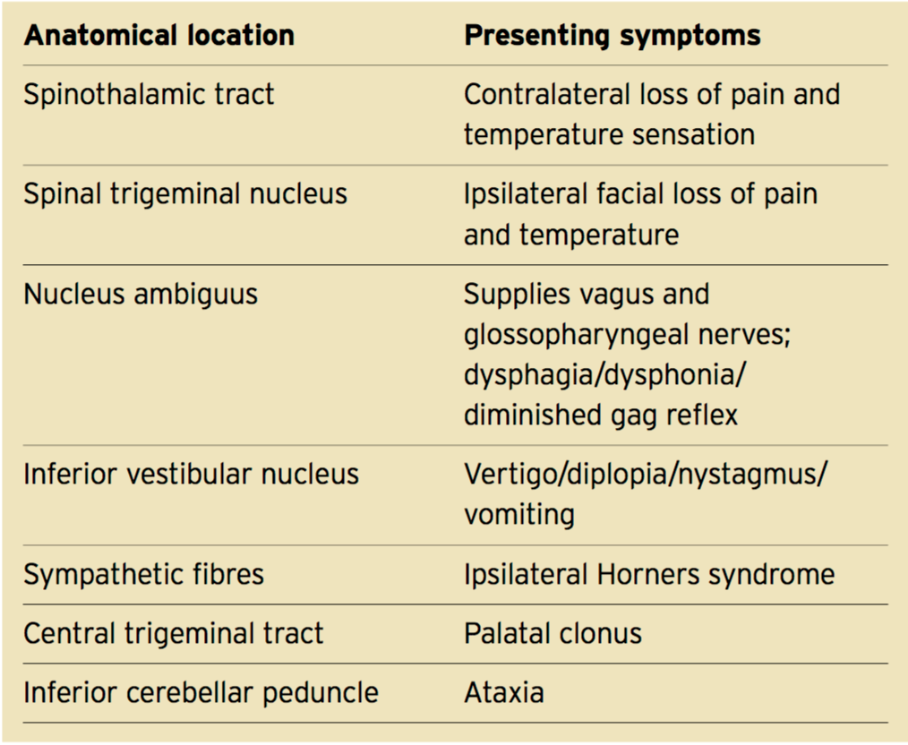 Wallenberg Syndrome Clinical Picture (based on location). Adapted from Nicholson (2009)