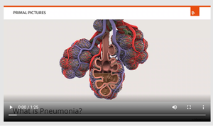 What is pneumonia.png