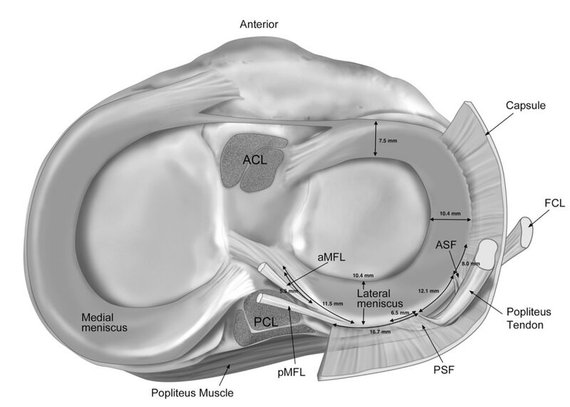 File:Caudal view of posterolateral attachments of lateral meniscus.jpeg