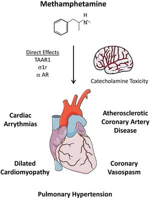 Methamphetamine Use and Cardiovascular Disease.jpg