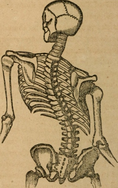 File:Scoliosis skeleton image.jpeg