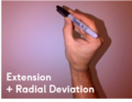 Extension/radial deviation