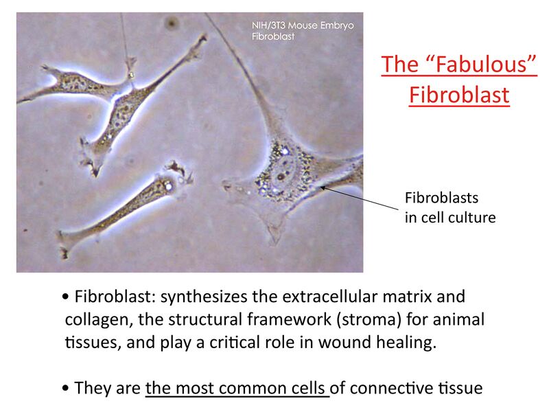 File:Fibroblast.jpeg