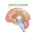 Area in green denotes the corpus callosum