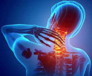 Treating Neck Pain and Stiffness - Part 1, Massage Tutorial, Neck, Neck  Massage and more