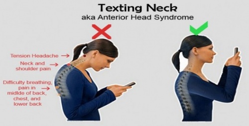 Image result for text neck image"