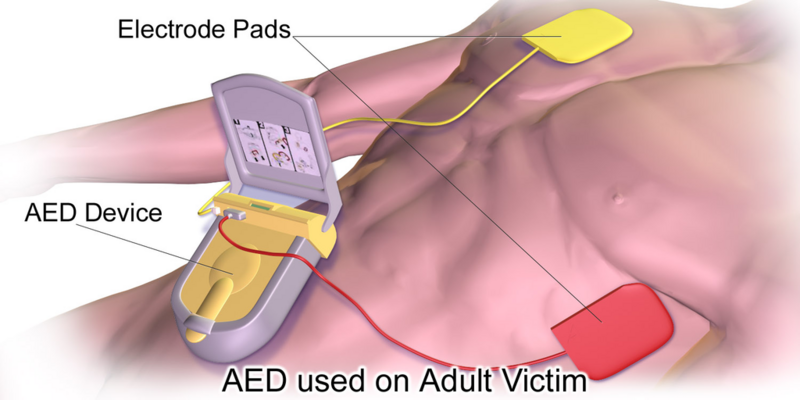 File:Automated External Defibrillator.png