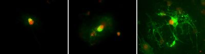 Oligodendrocyte development Olig2 and CNPase.jpg