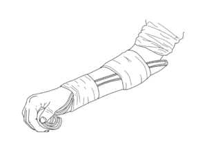 Image showing arm splint