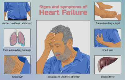 Depiction of a person suffering from heart failure.png