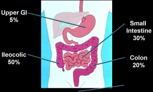 Crohn's distribution.jpg