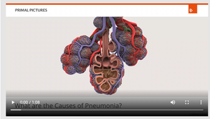 Causes of pneumonia.png