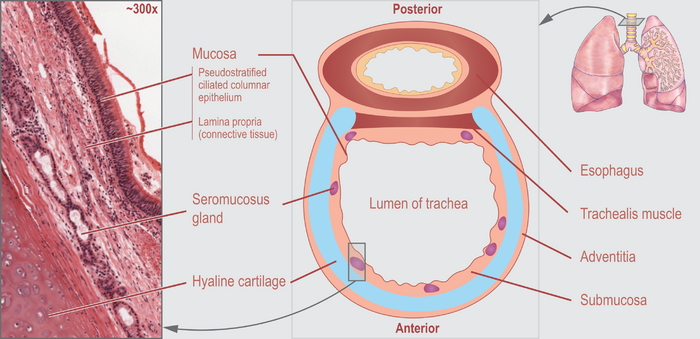 Laryngomalacia and Tracheomalacia | Concise Medical Knowledge