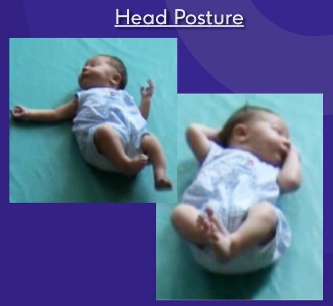 File:Head posture.jpg