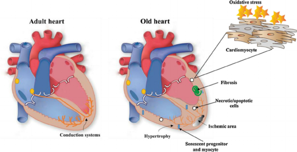 Fig-2-Changes-in-the-myocardium-during-aging-Heart-and-vasculature-undergo-alterations.png