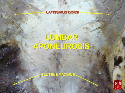 Lumbar aponeurosis.jpeg