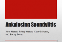 Ankylosing spondylitis ppt.PNG