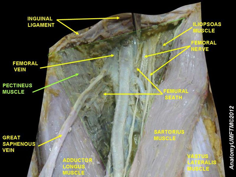 File:Pectineus Muscle anatomy.jpg