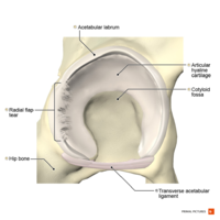 Radial fibrillated labral tear Primal.png