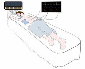 Fig. 1.1 - 'Swimmer's position' in prone. Ideal for regulating breathing